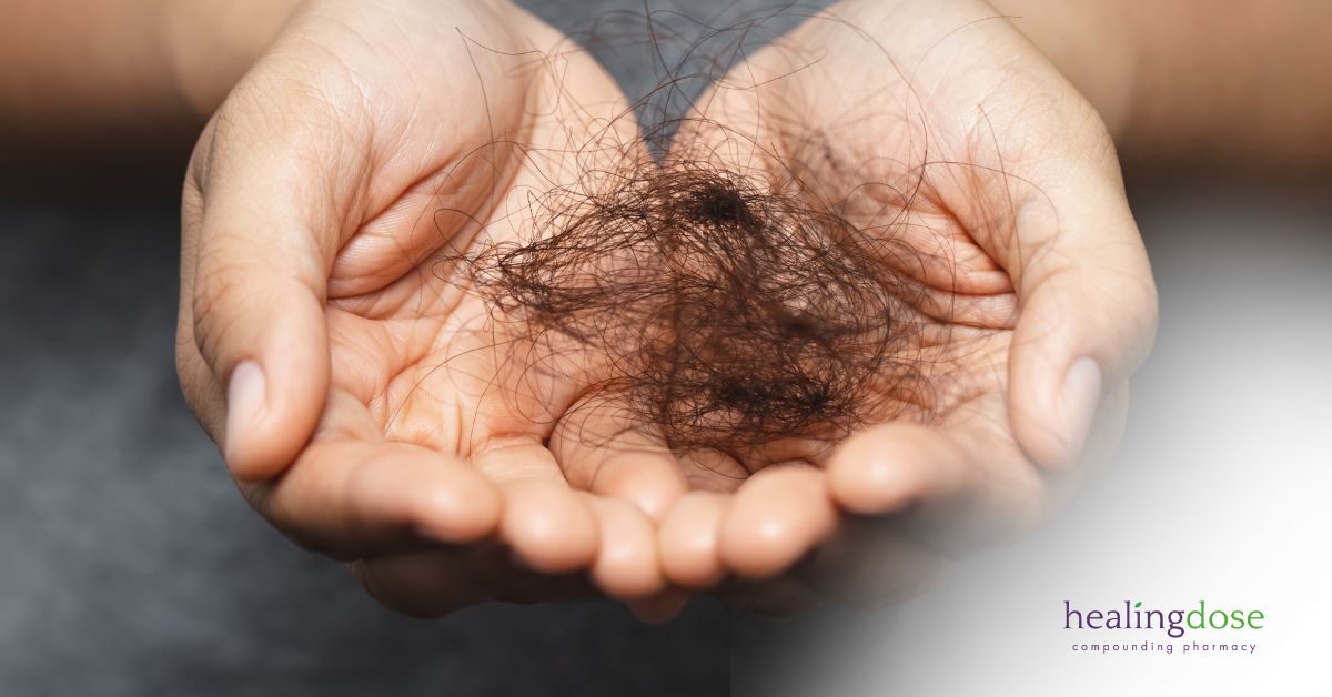How-the-best-help-to-stop-Hair-Loss-is-with-Compounding-Pharmacies-Alopecia-img
