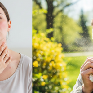 Mihcigan Ketotifen Mast Cell Stabilizer for Mast Cell Activation Syndrome Allergy Symptoms