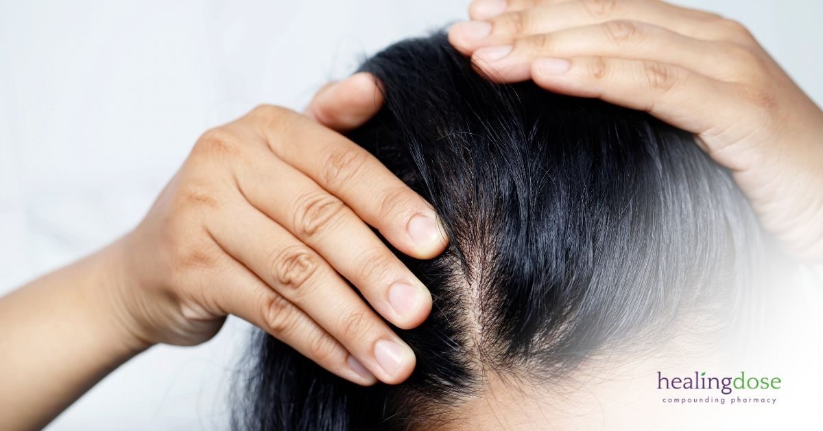 androgenic-alopecia-microneedling-hair-loss-michigan-compounding-pharmacy