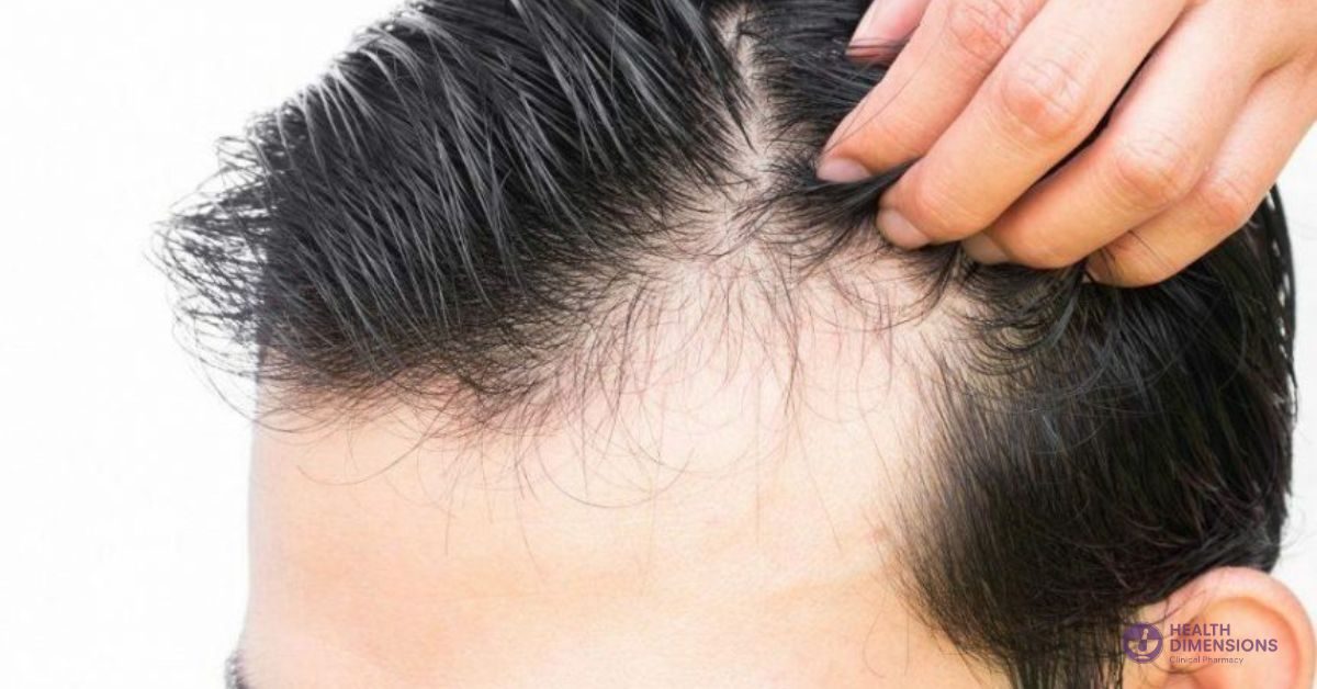 hair-loss-and-the-flaws-with-current-treatments